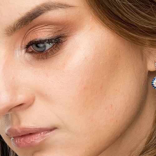 Glamour Retouching before